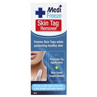 medi freeze skin tag remover